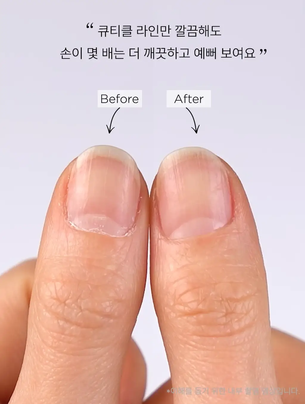 [NEW] 르멘트 큐티클 이지 오프 펜 1.6ml 단품/기획 상세페이지 8